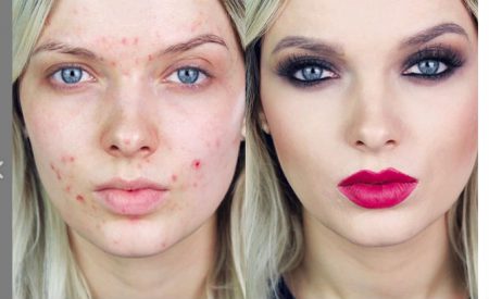 youtube-video-from-acne-make-up-coverage-guru-em-ford-called-you-look-disgusting-gets-417-million